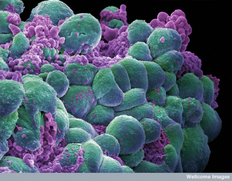 Cancer-Cells-HD-Photos-Collection2.jpg