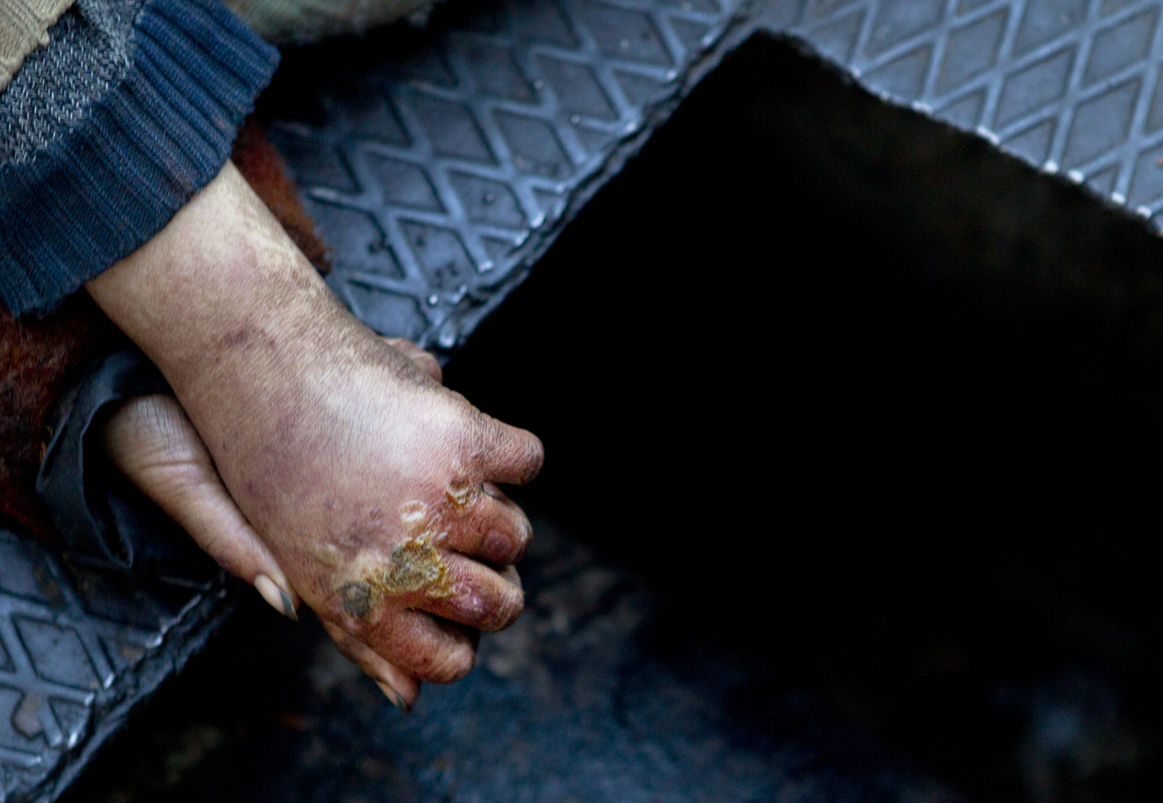 A homeless woman's hands.