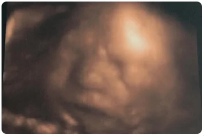 The Best $115 I’ve Spent This Year