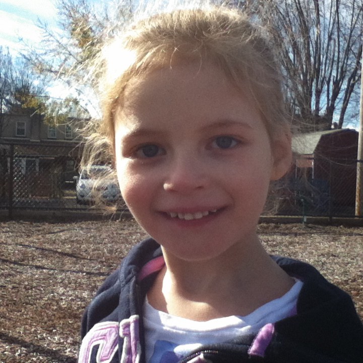 sierra_phelan_mcdermid_syndrome.jpg