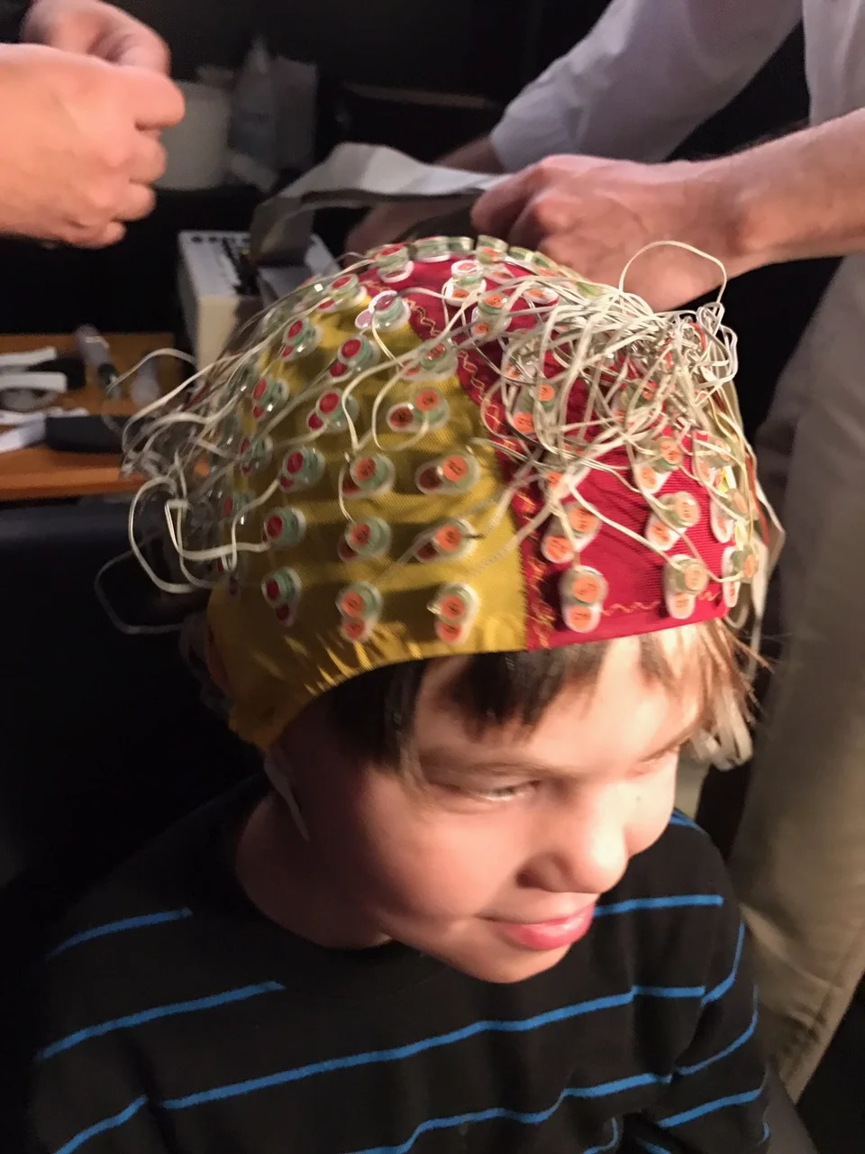 Specialized EEG with over 100 leads!
