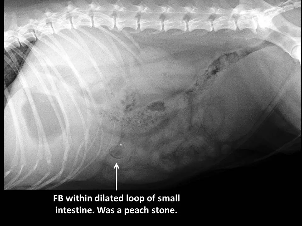 Small intestinal foreign body (1)