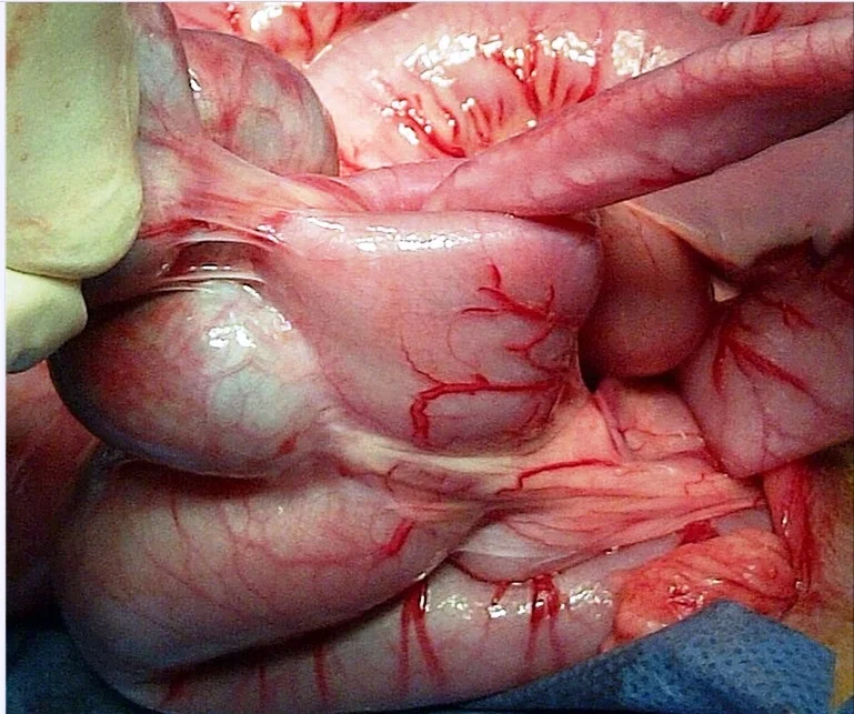 Ileocaecal intestinal intussusception in a dog