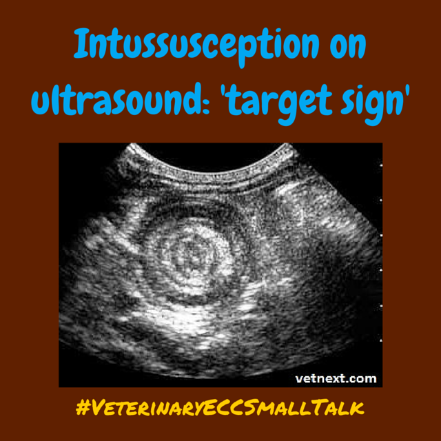 'Target sign' appearance of intussusception on ultrasound