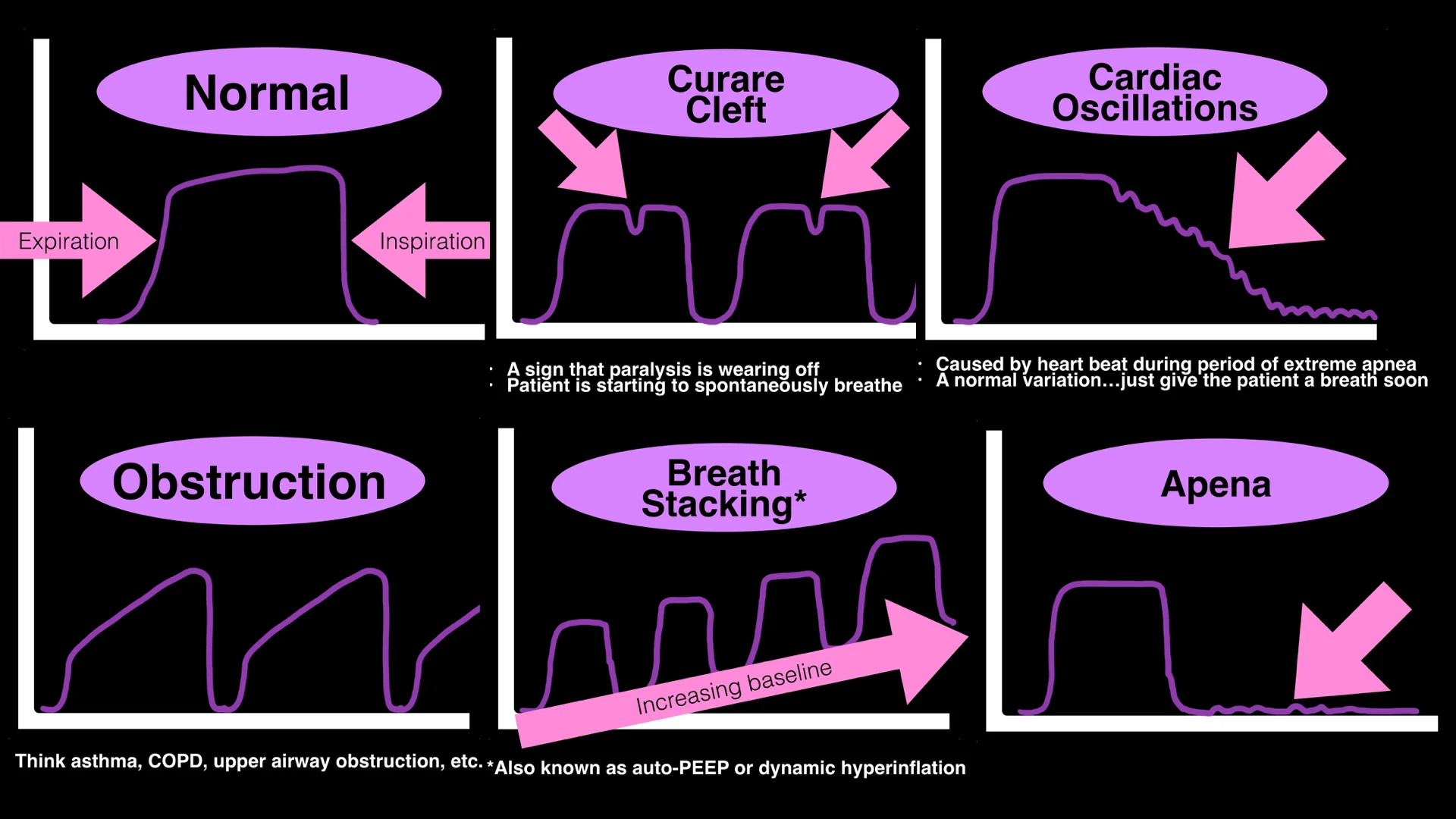 Some capnograph waveforms