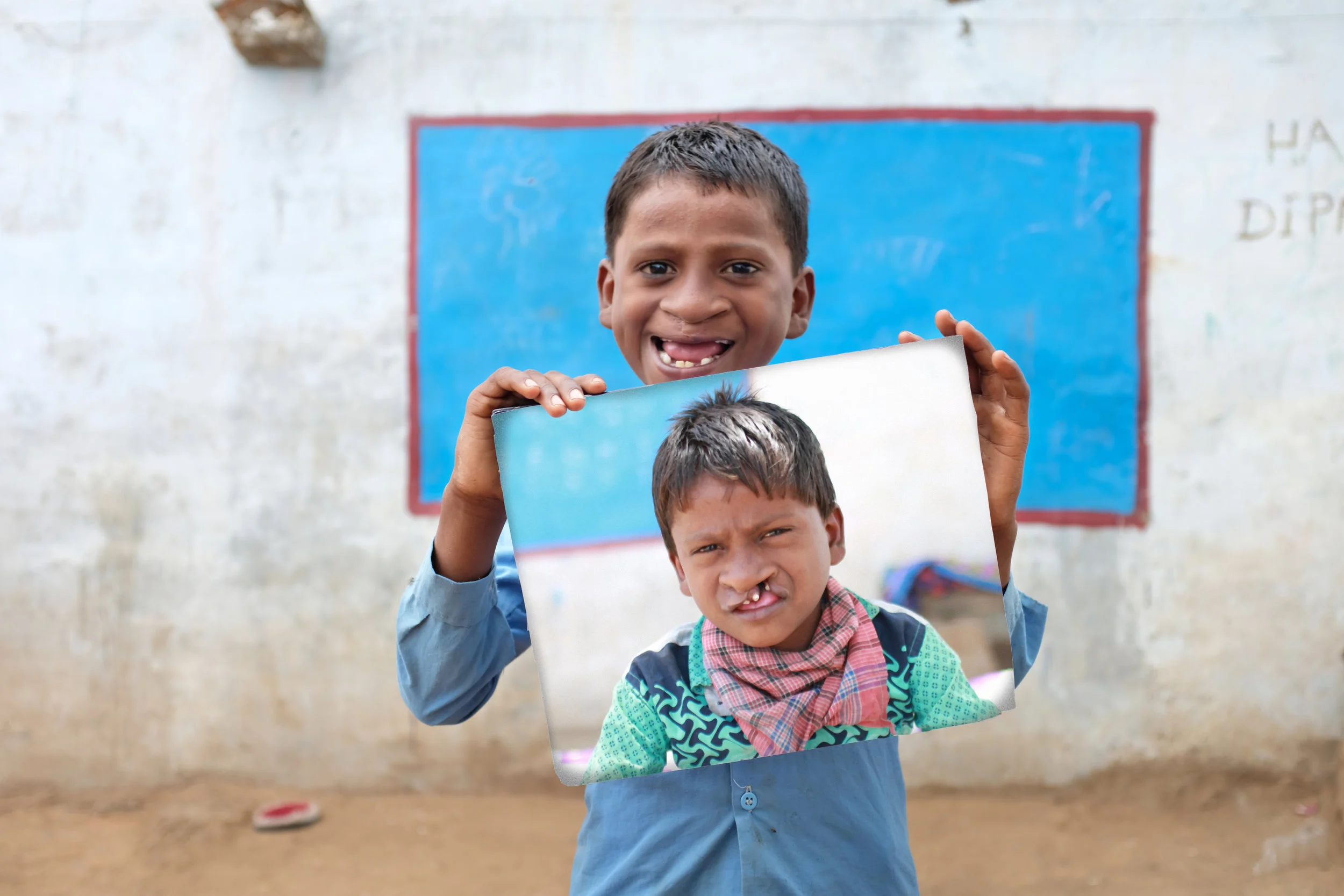 Photo Credit: Smile Train