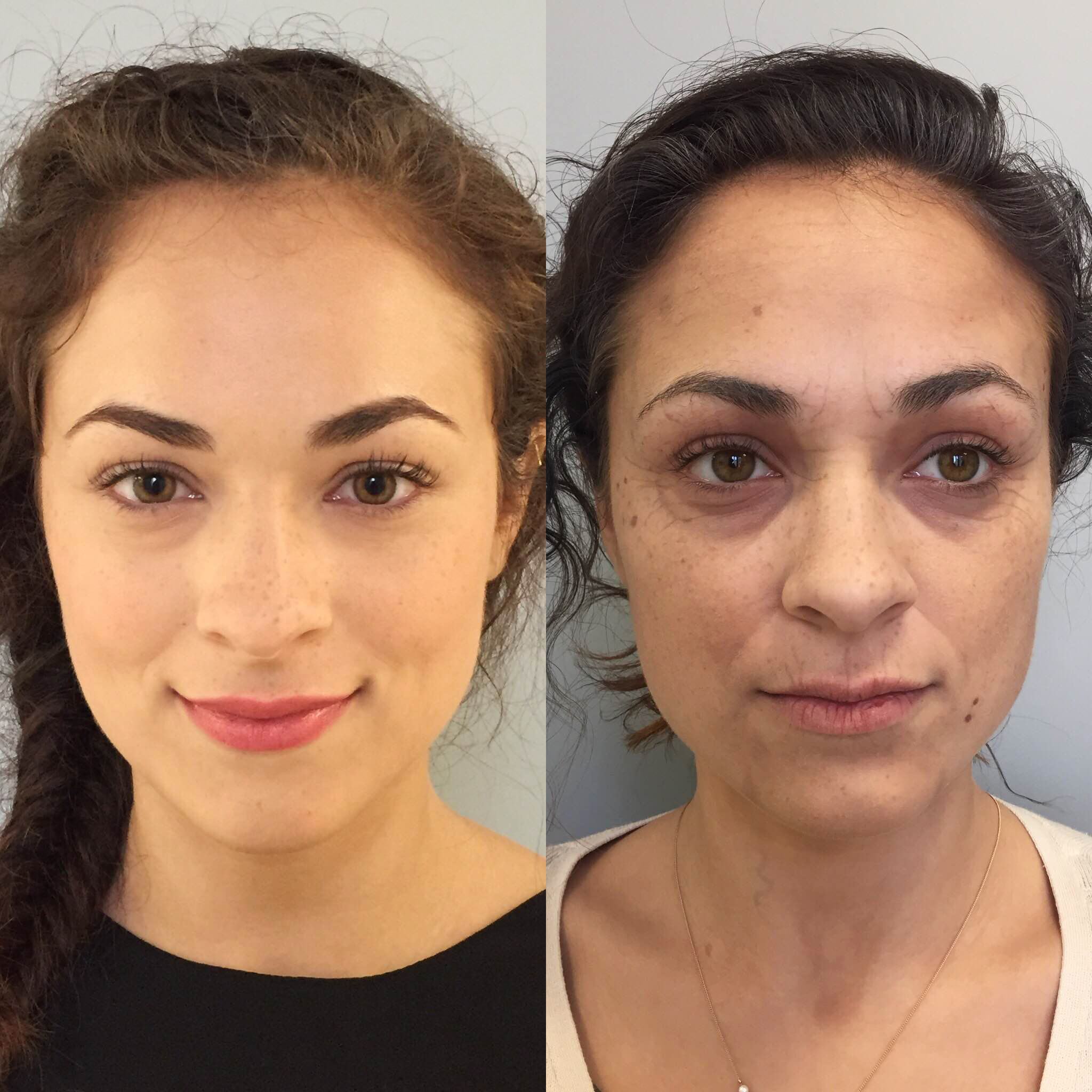 "Paint and Powder" Old Age Before and After