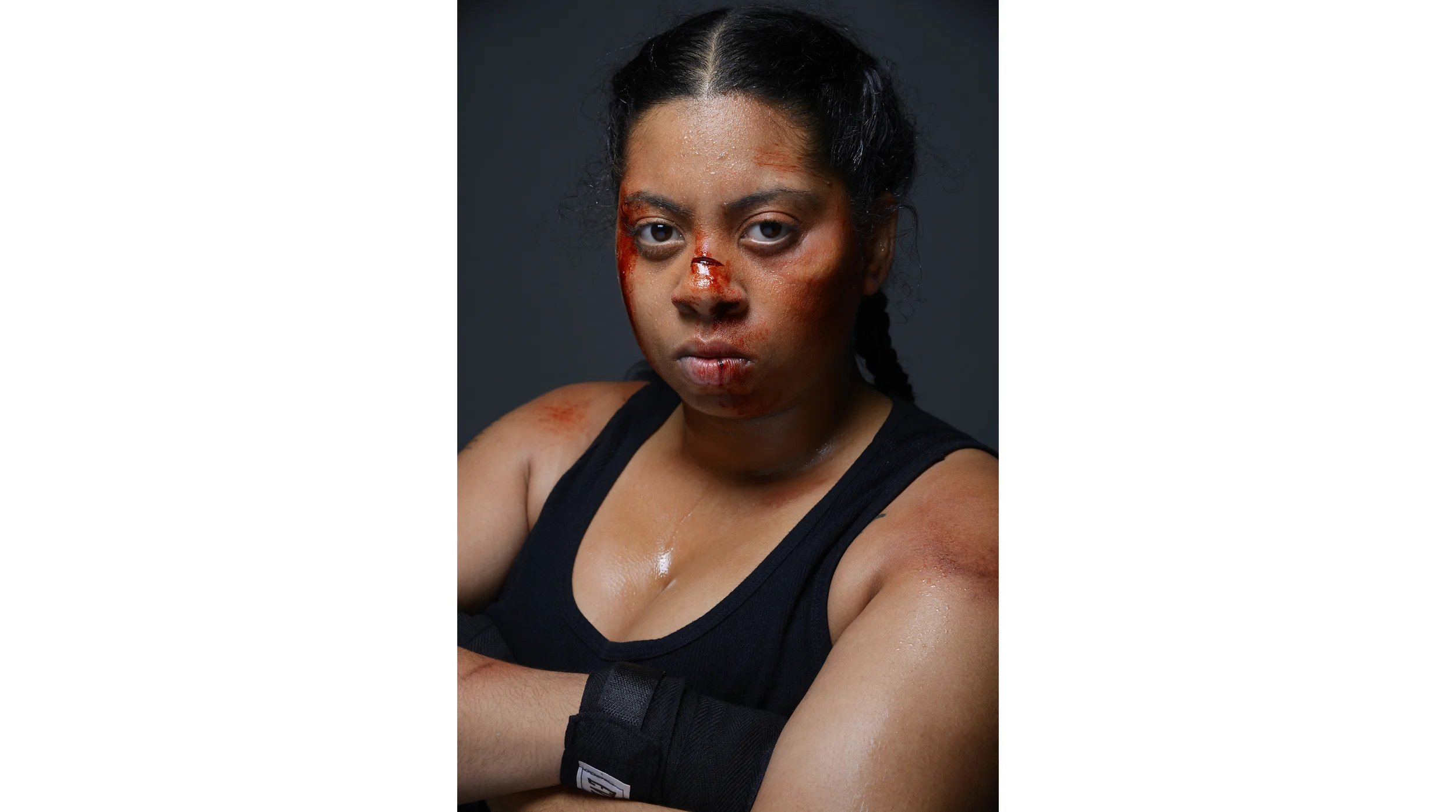 Boxer make-up with pros-aide transfer and hand-painted alcohol color injuries