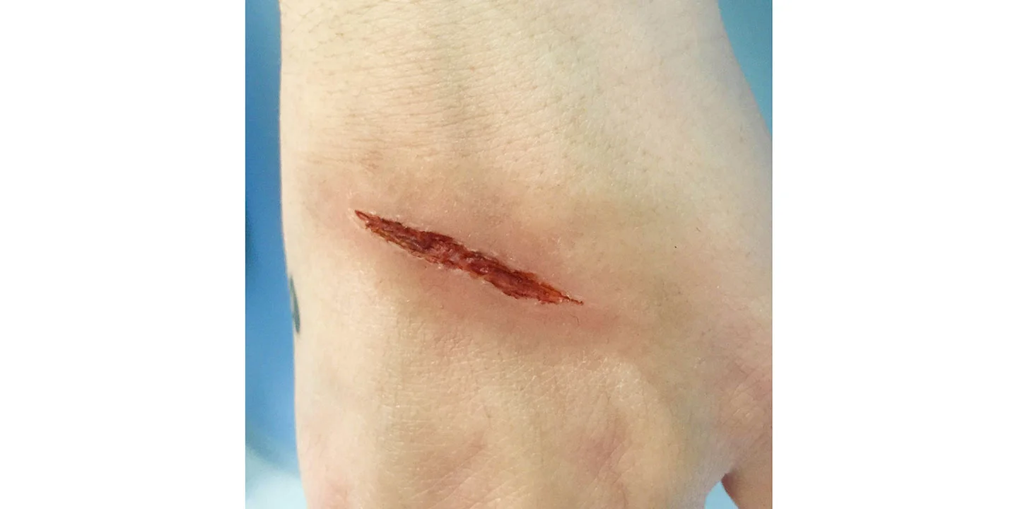 Custom sculpted cut with 3rd degree silicone