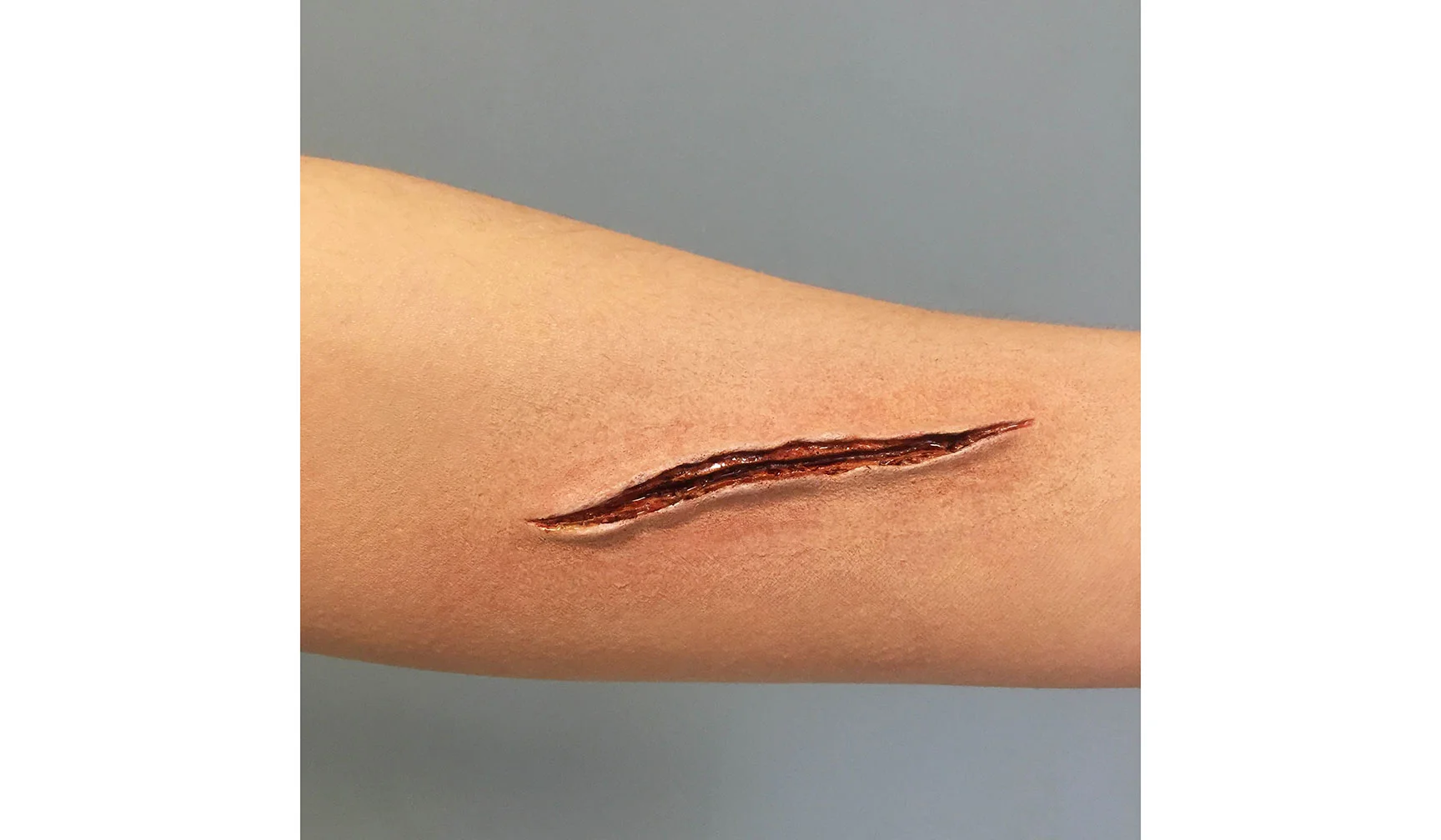 Foam latex prosthetic injury
