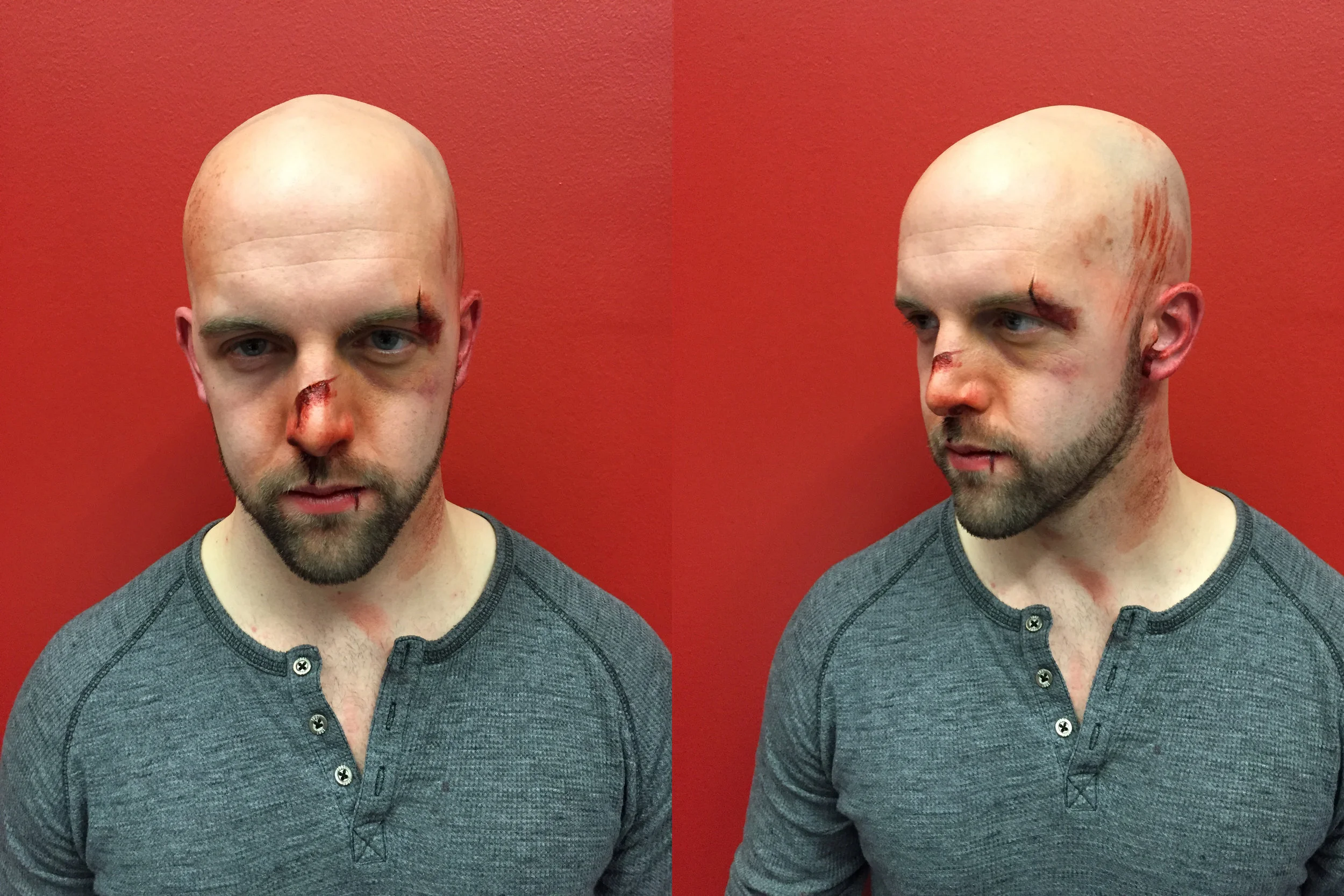 Mike Petrie as a beaten up man for the short film The Sage directed by Jeffrey Matos. Executed with alcohol color and Reel Creations stage blood.