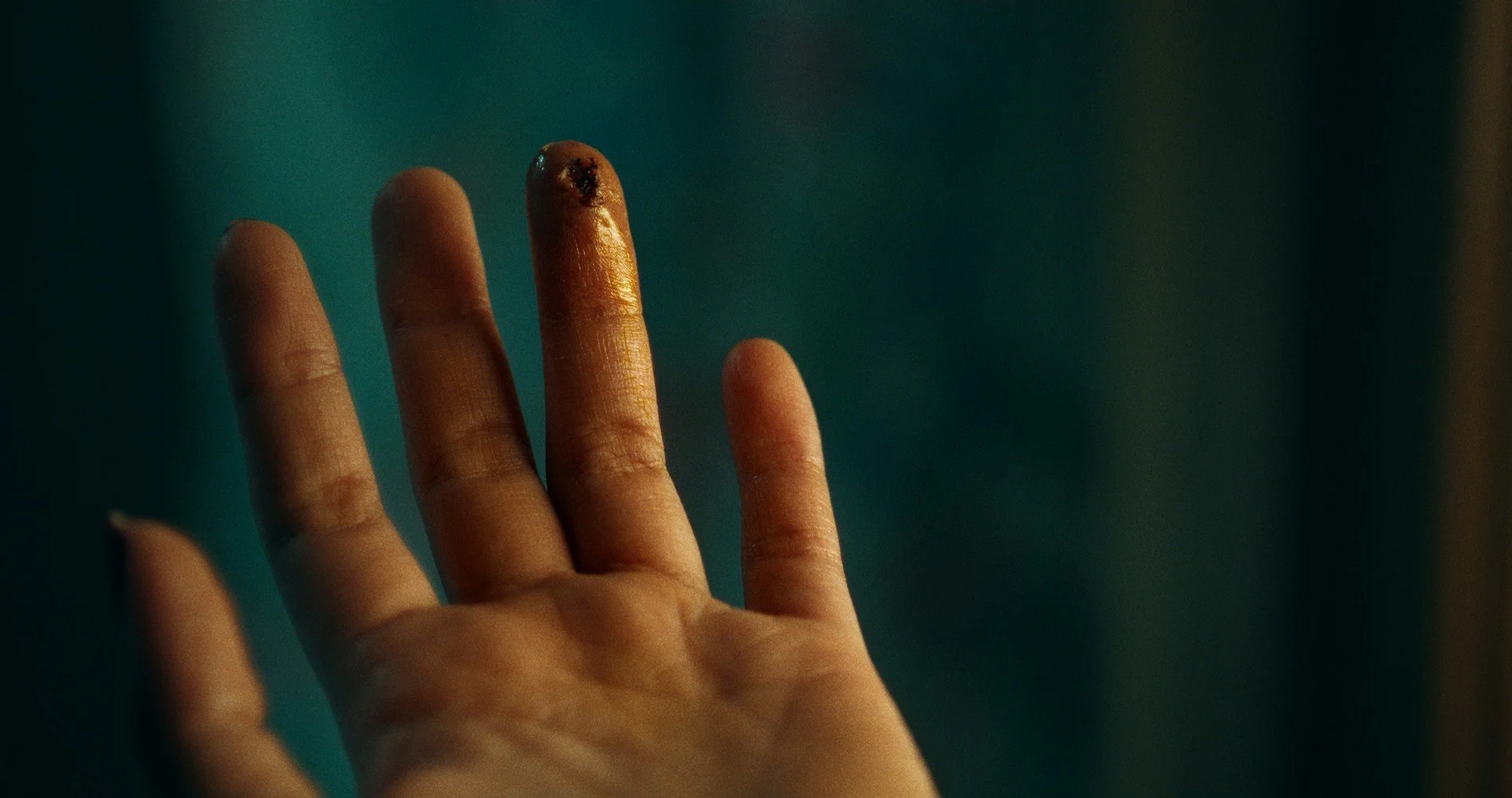 Ringworm,s.jpg