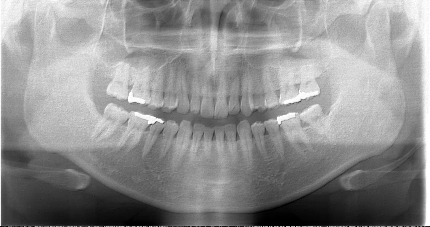 tooth.jpg