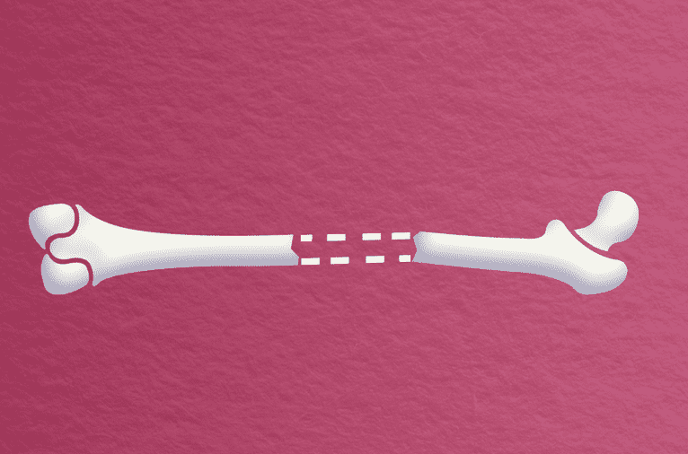 Algebra: From Broken Bones to Twitter Feuds