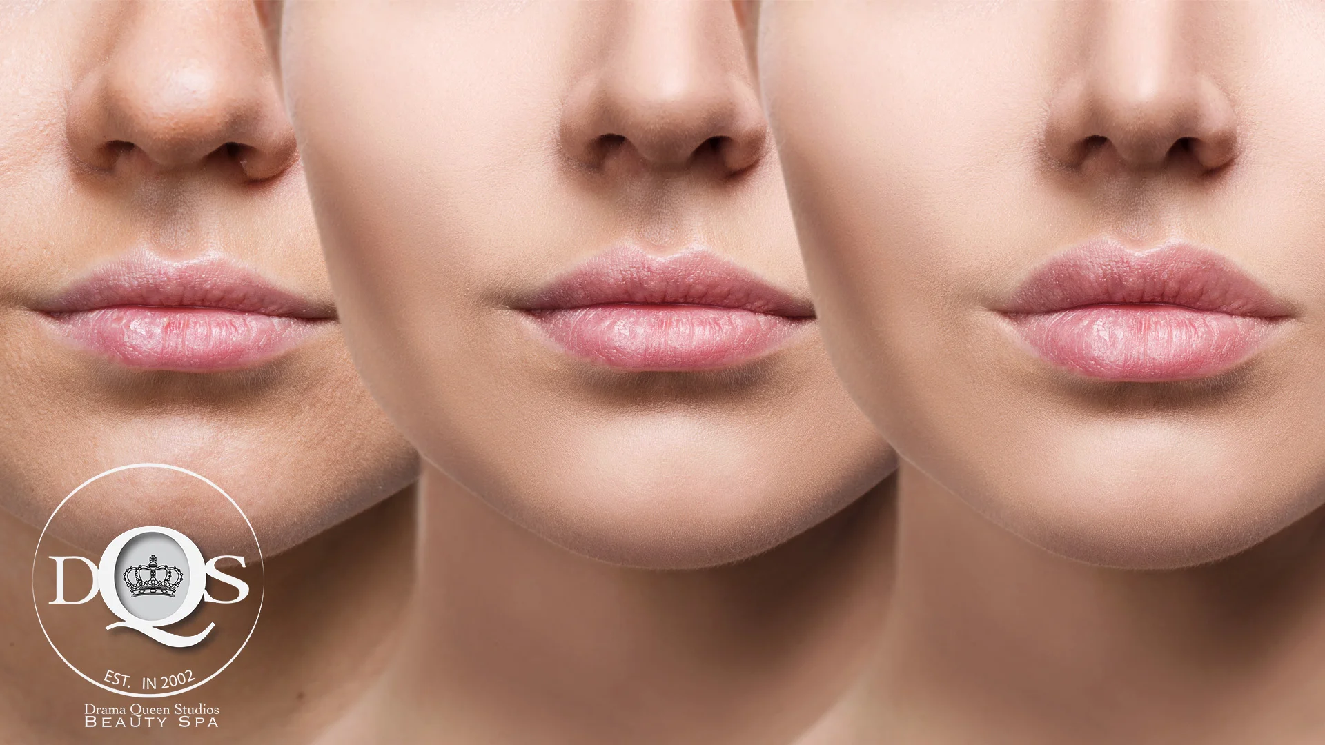 Lip-Filler-Blog-May232018.jpg