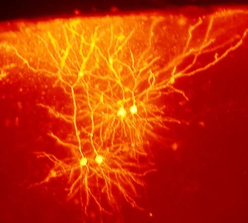 Neurones in a mouse brain. Photo shared by Neurollero .