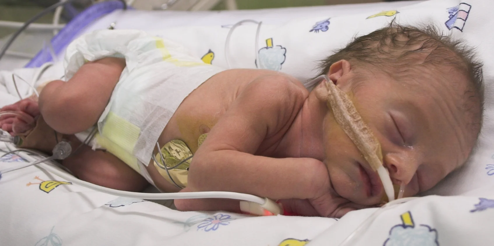 Preemie baby in incubator on oxygen