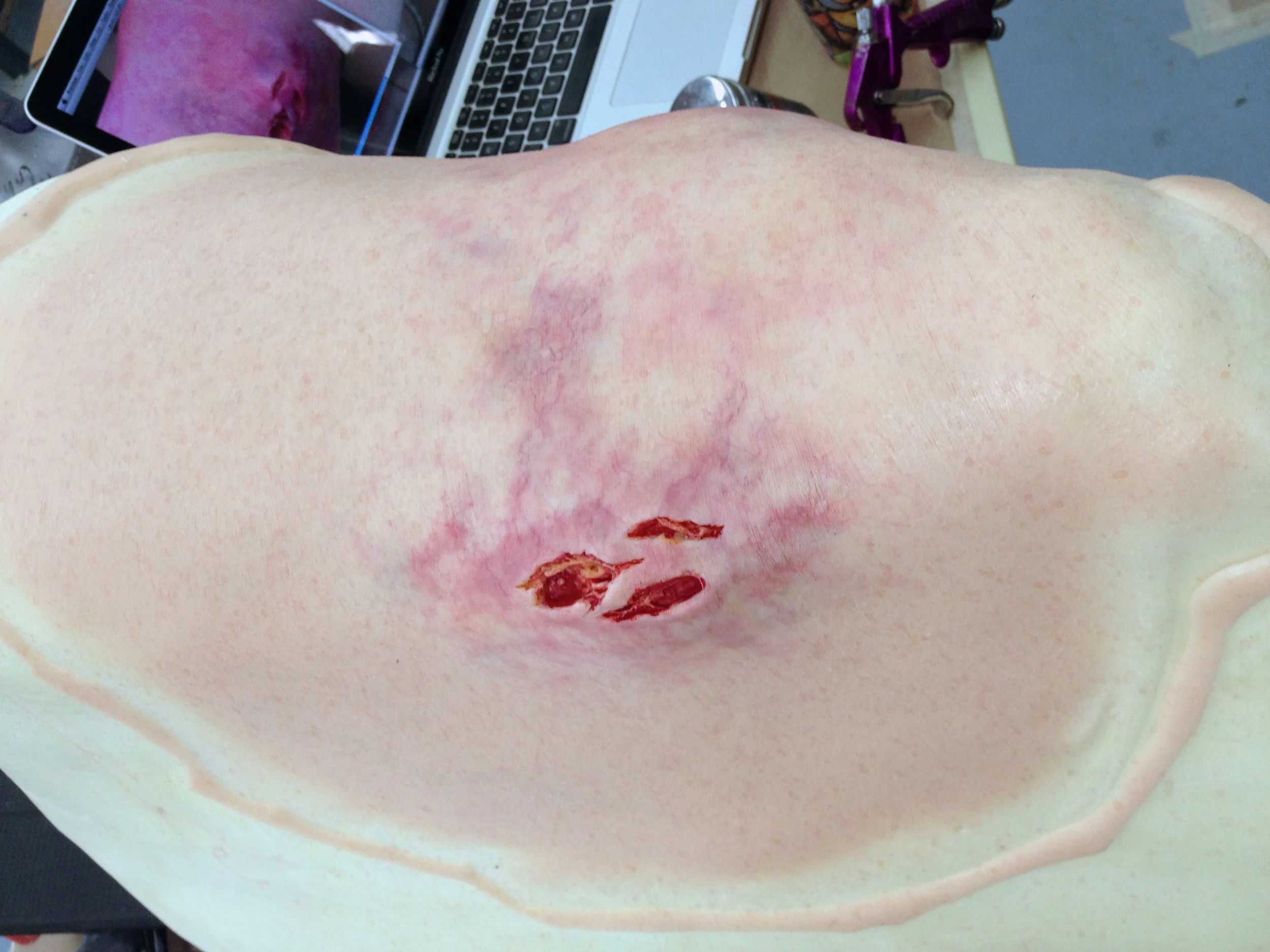 The Knick - Leg stabbing appliance  