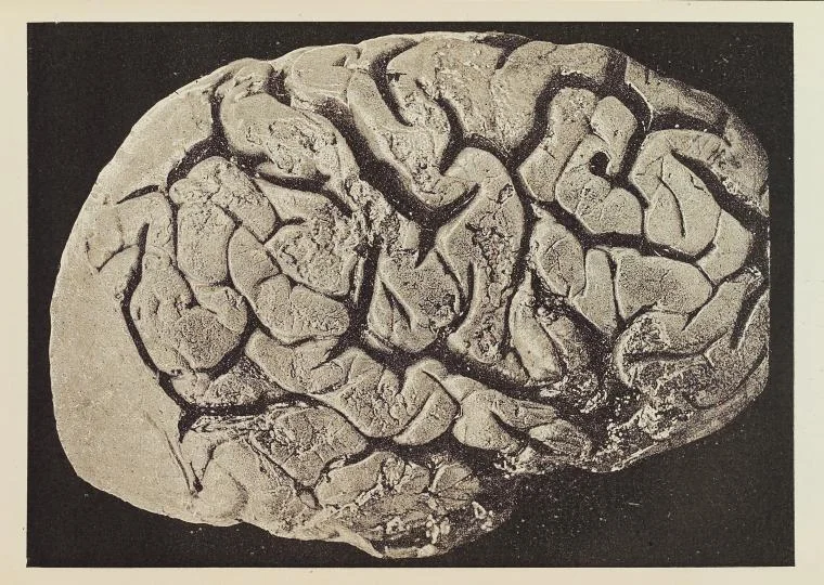 What We Know (and Don’t Know) About RankBrain