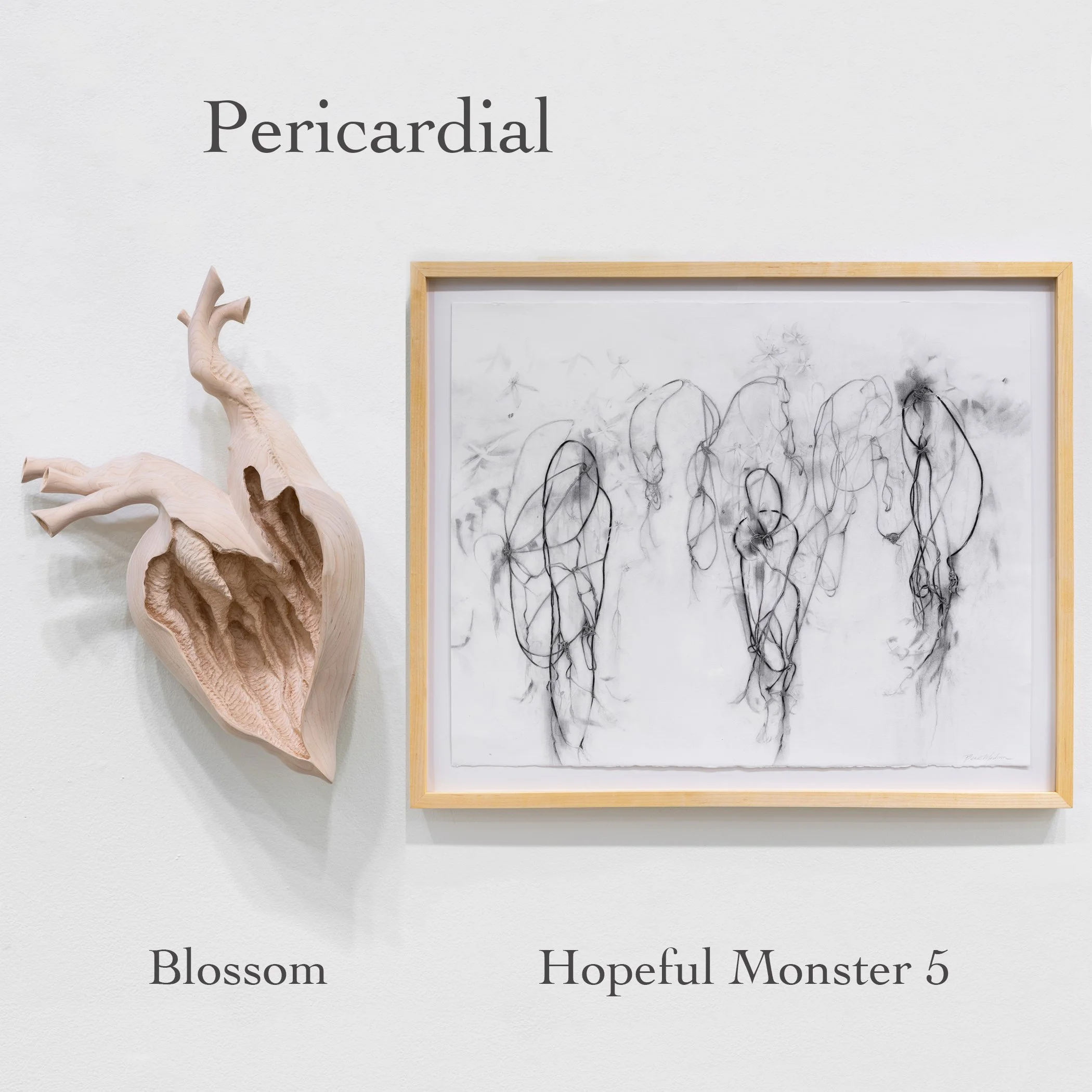 Pericardial Triad.jpg