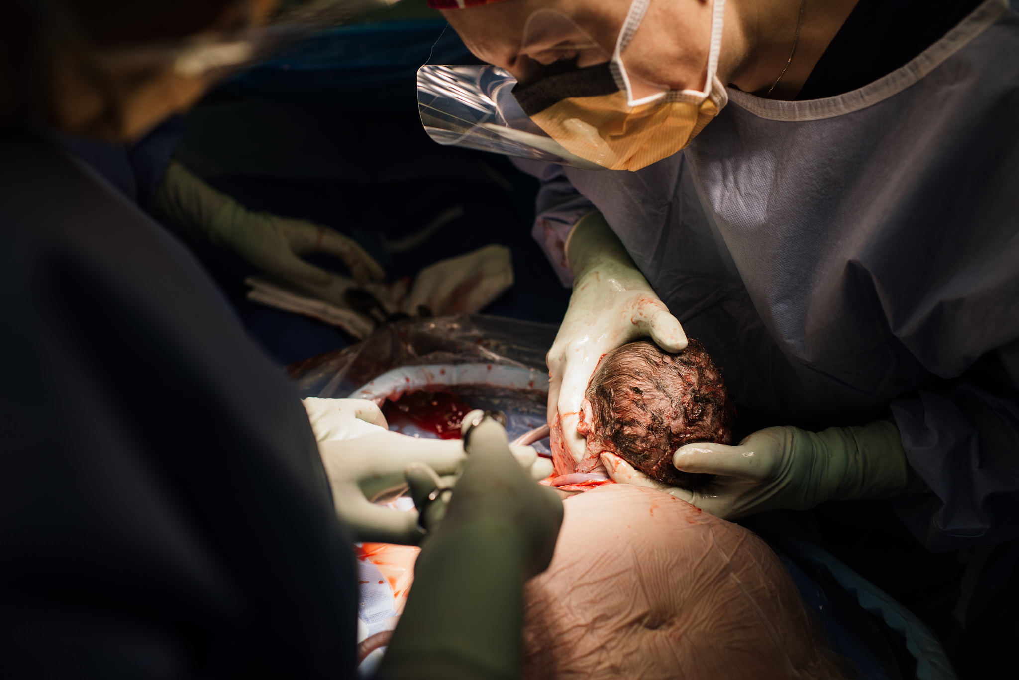 Aspen c-section-50.jpg