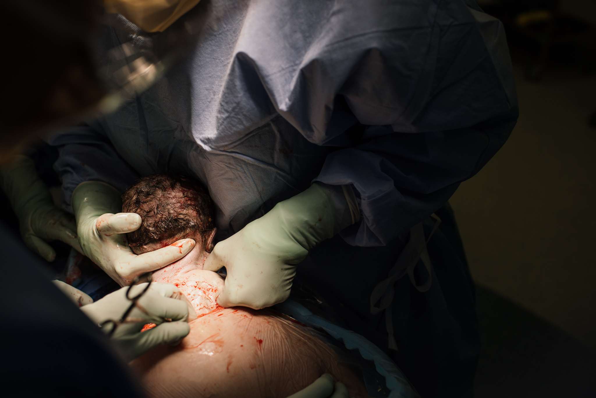 Aspen c-section-52.jpg
