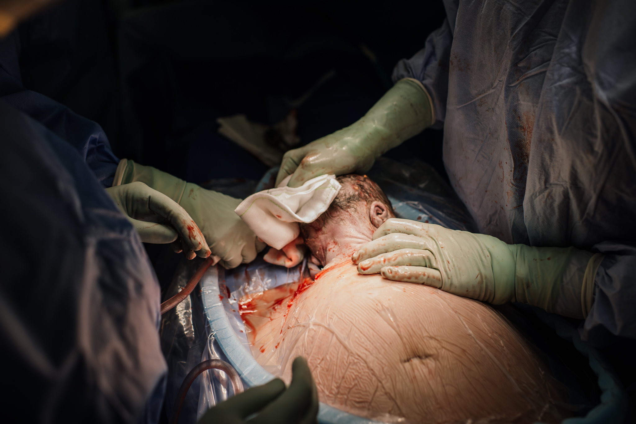 Aspen c-section-53.jpg