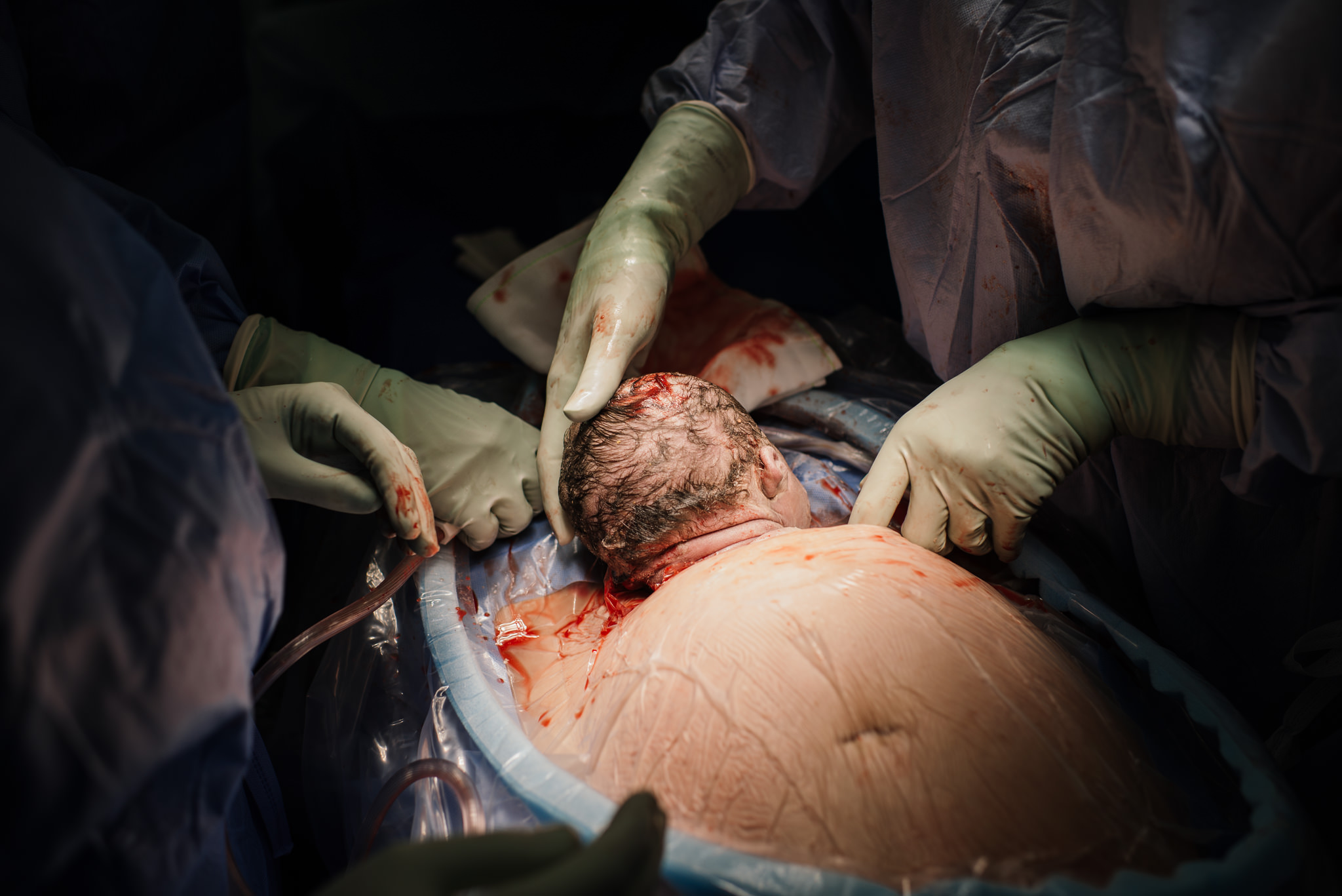 Aspen c-section-54.jpg