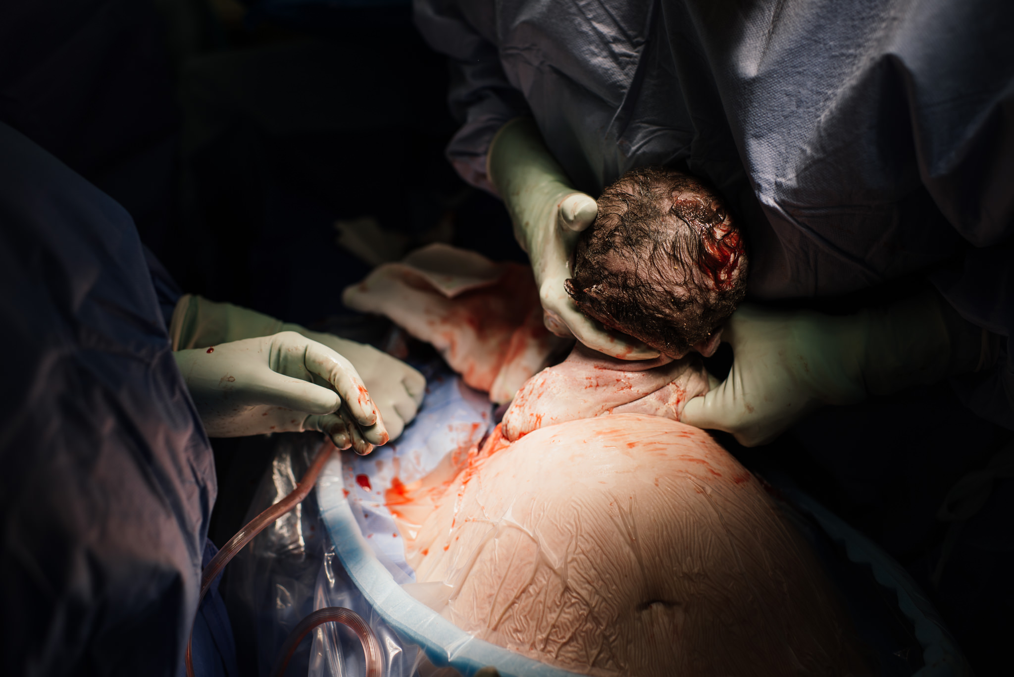 Aspen c-section-55.jpg