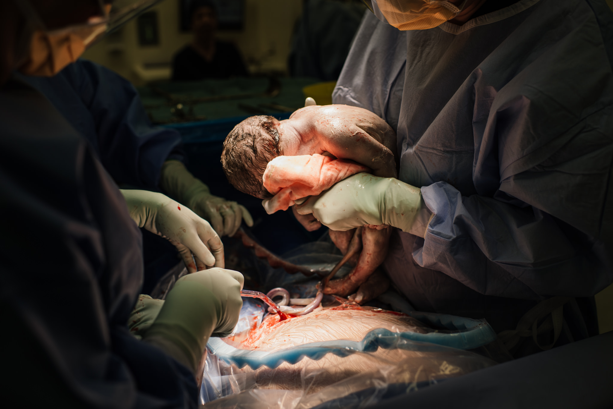 Aspen c-section-58.jpg