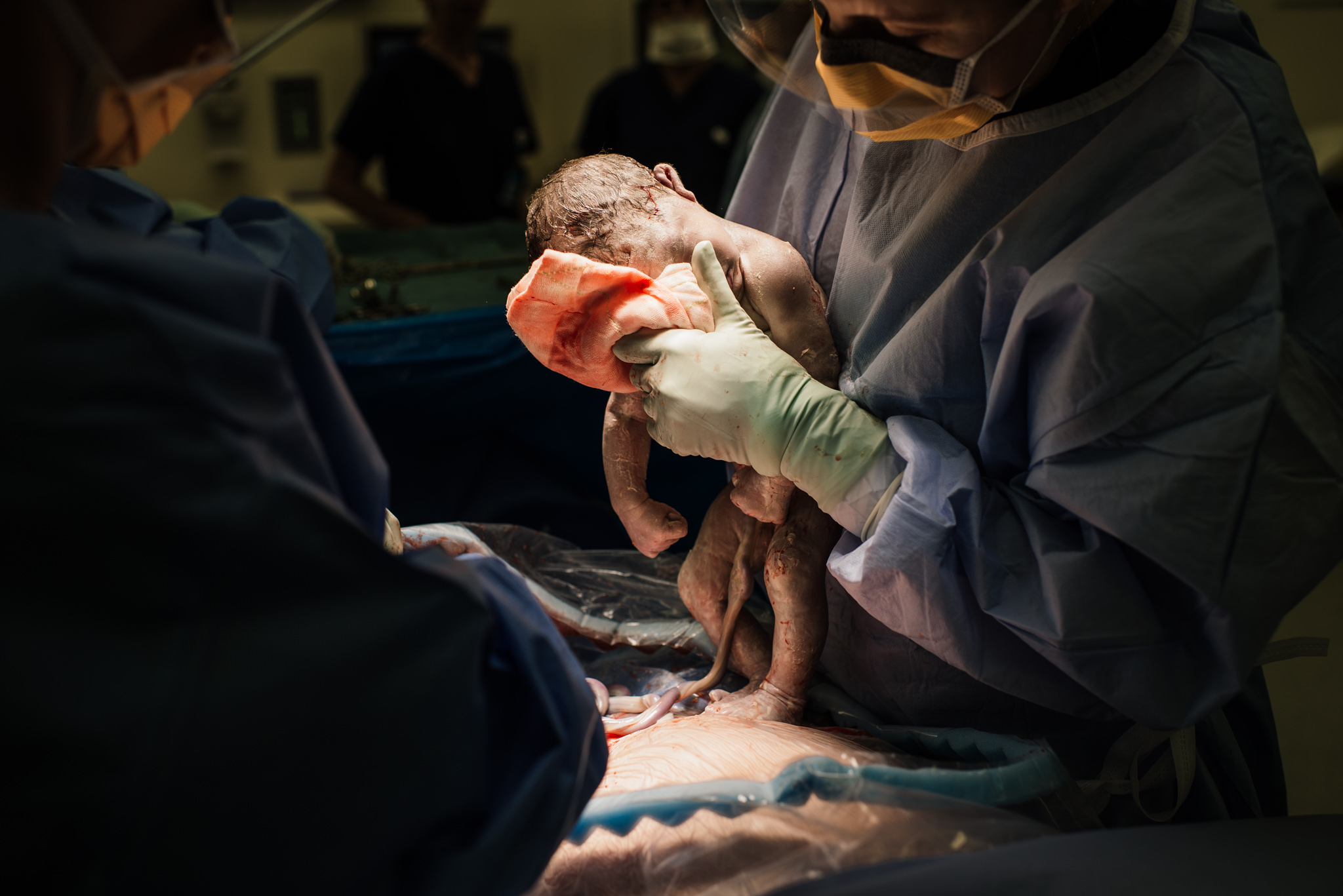Aspen c-section-60.jpg