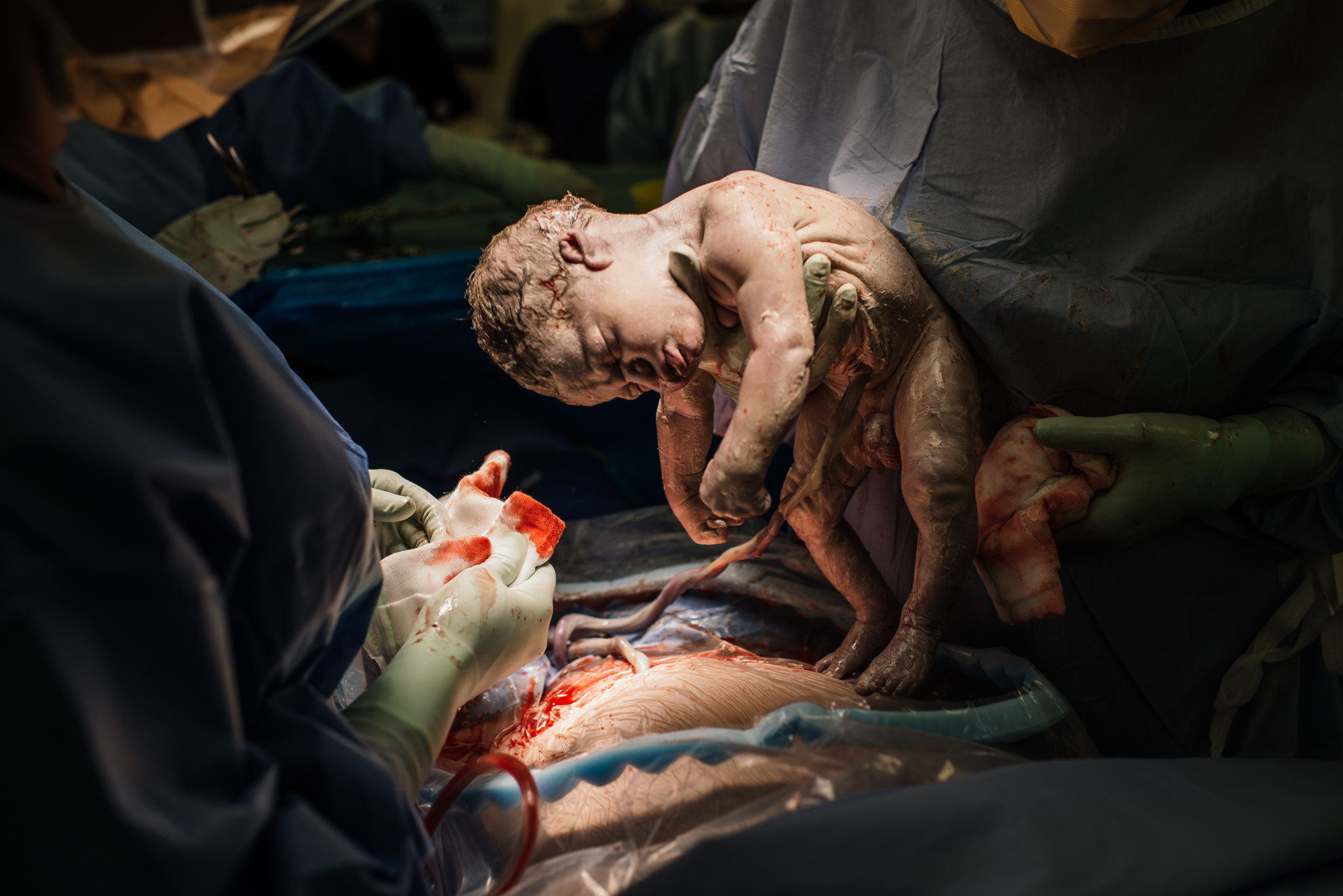 Aspen c-section-61.jpg