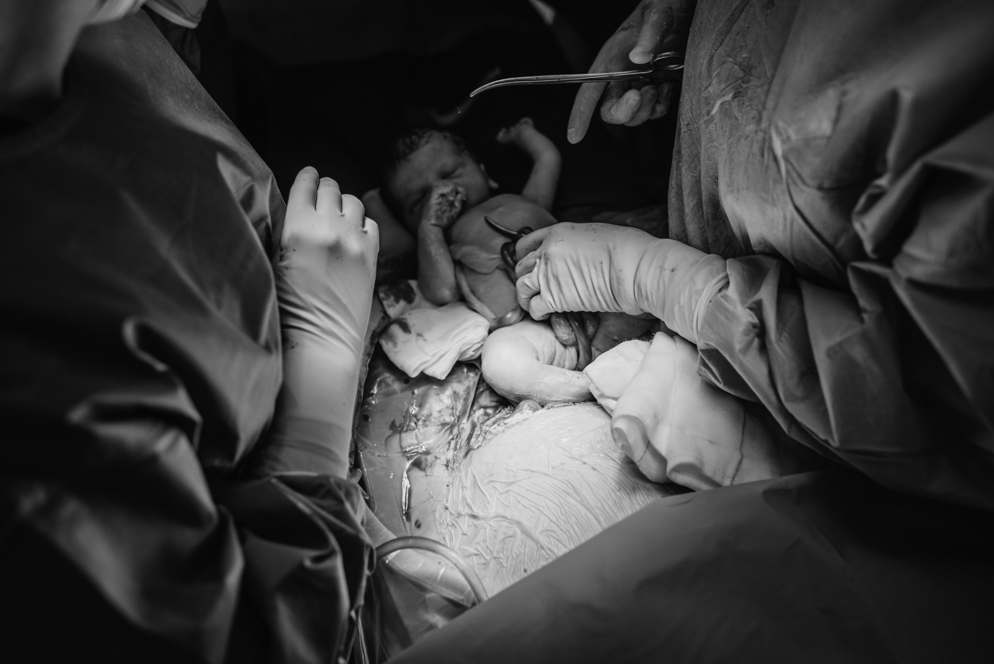 Aspen c-section-70.jpg