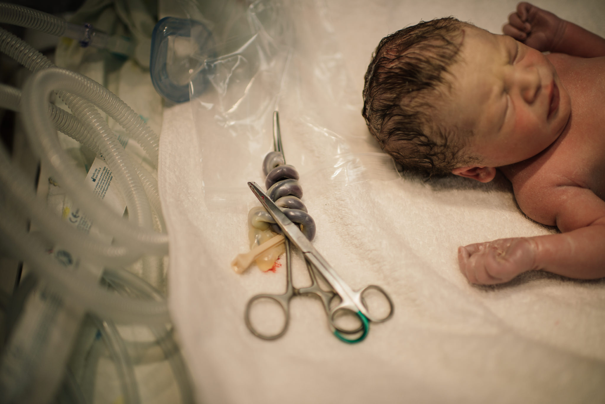 Aspen c-section-80.jpg