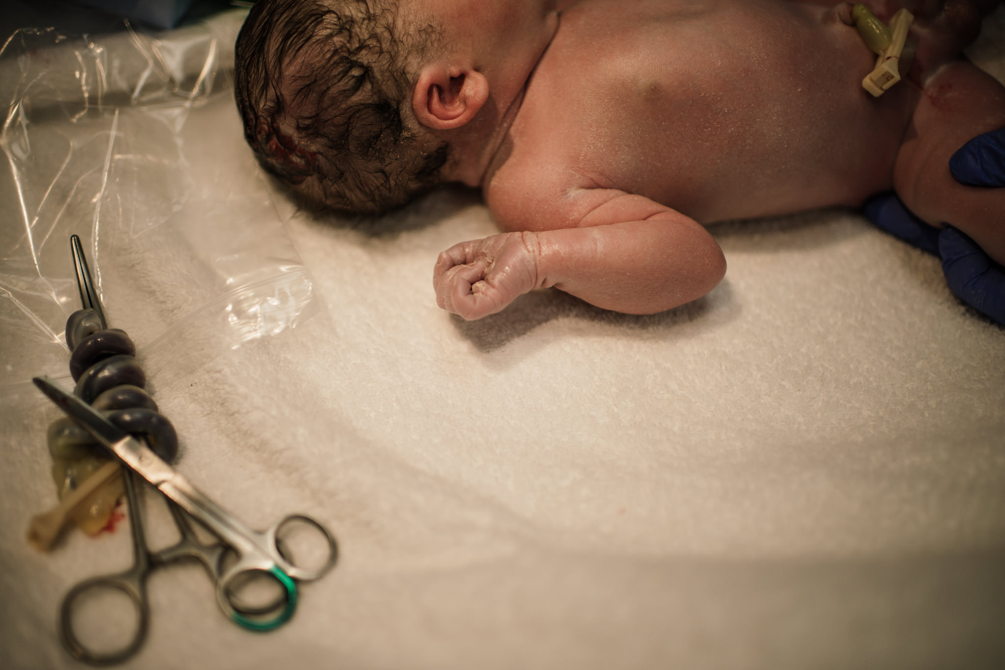 Aspen c-section-81.jpg
