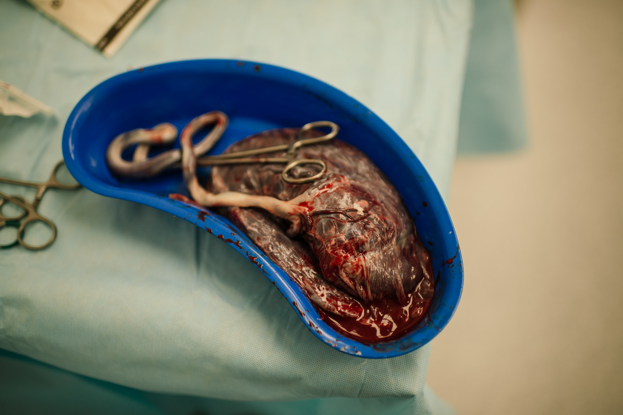 Aspen c-section-95.jpg