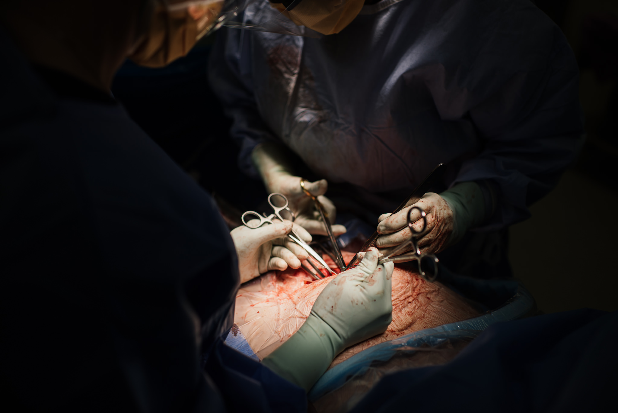 Aspen c-section-101.jpg