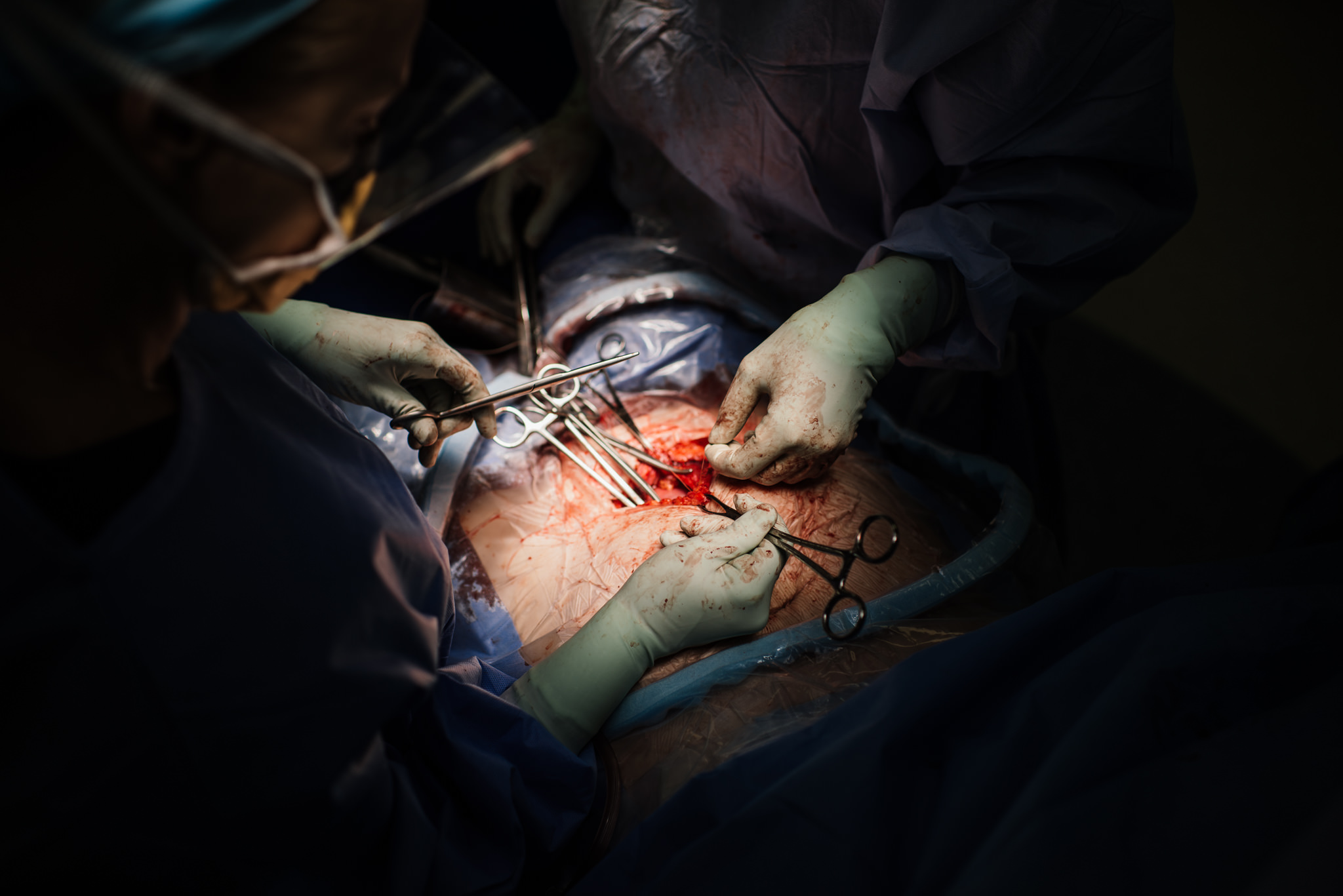Aspen c-section-103.jpg
