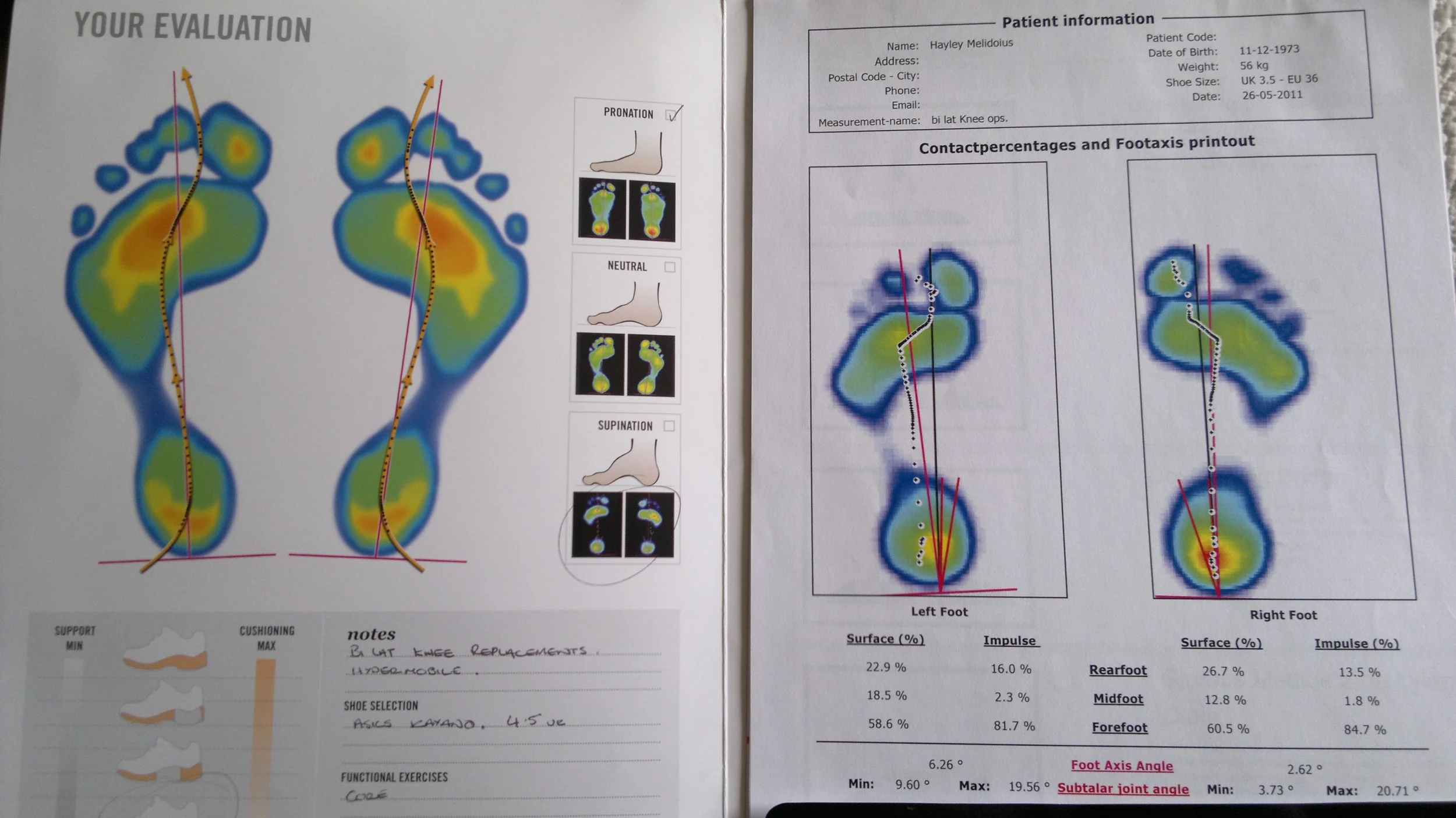 This is the foot analysis documentation you receive and are explained about your characteristics by your fitter.