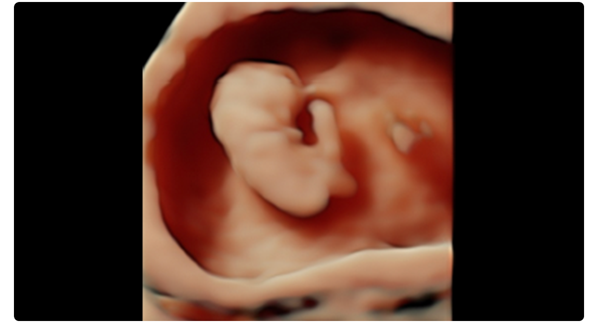 3D First Trimester Fetus