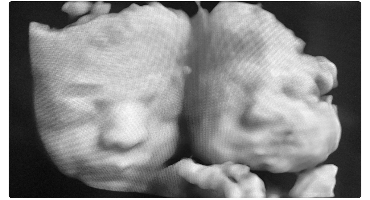 Twin Faces