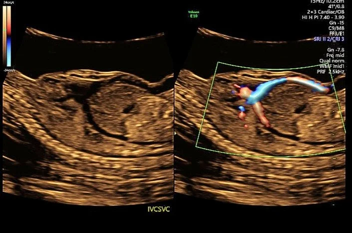 March Intersting Case_ADV.jpg