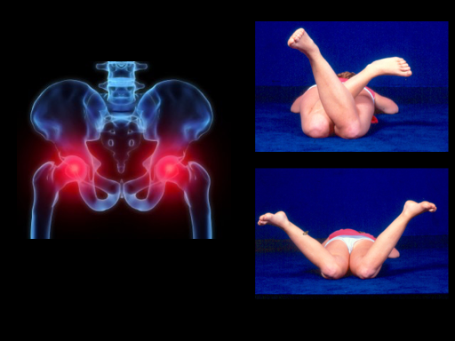 Ortopedia Pediátrica Prof. Dr. Roberto Guarniero