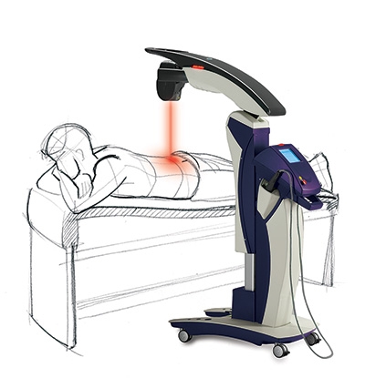 The MLS laser therapy now available at the Woodside Clinic.