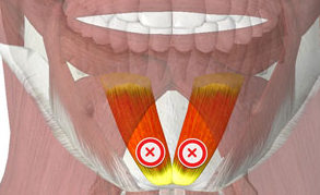 Botox for an orange peel chin