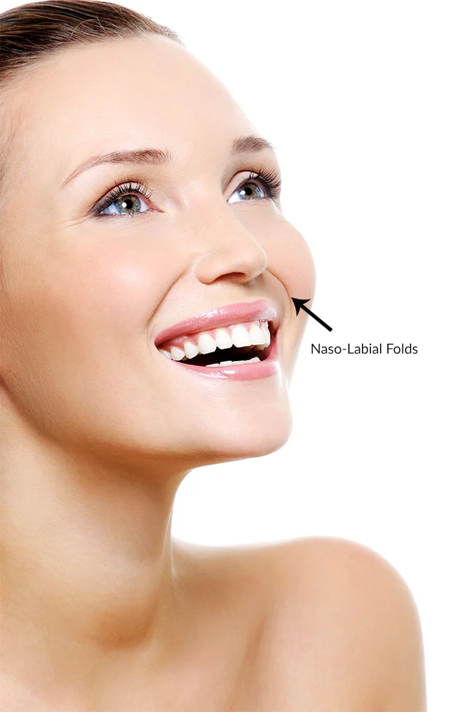 Nasolabial Folds - Dermal Filler Training