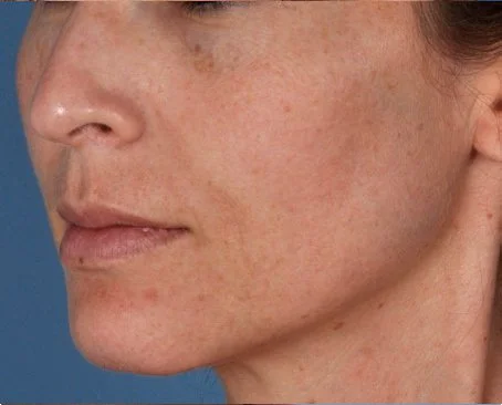 zo advanced night repair