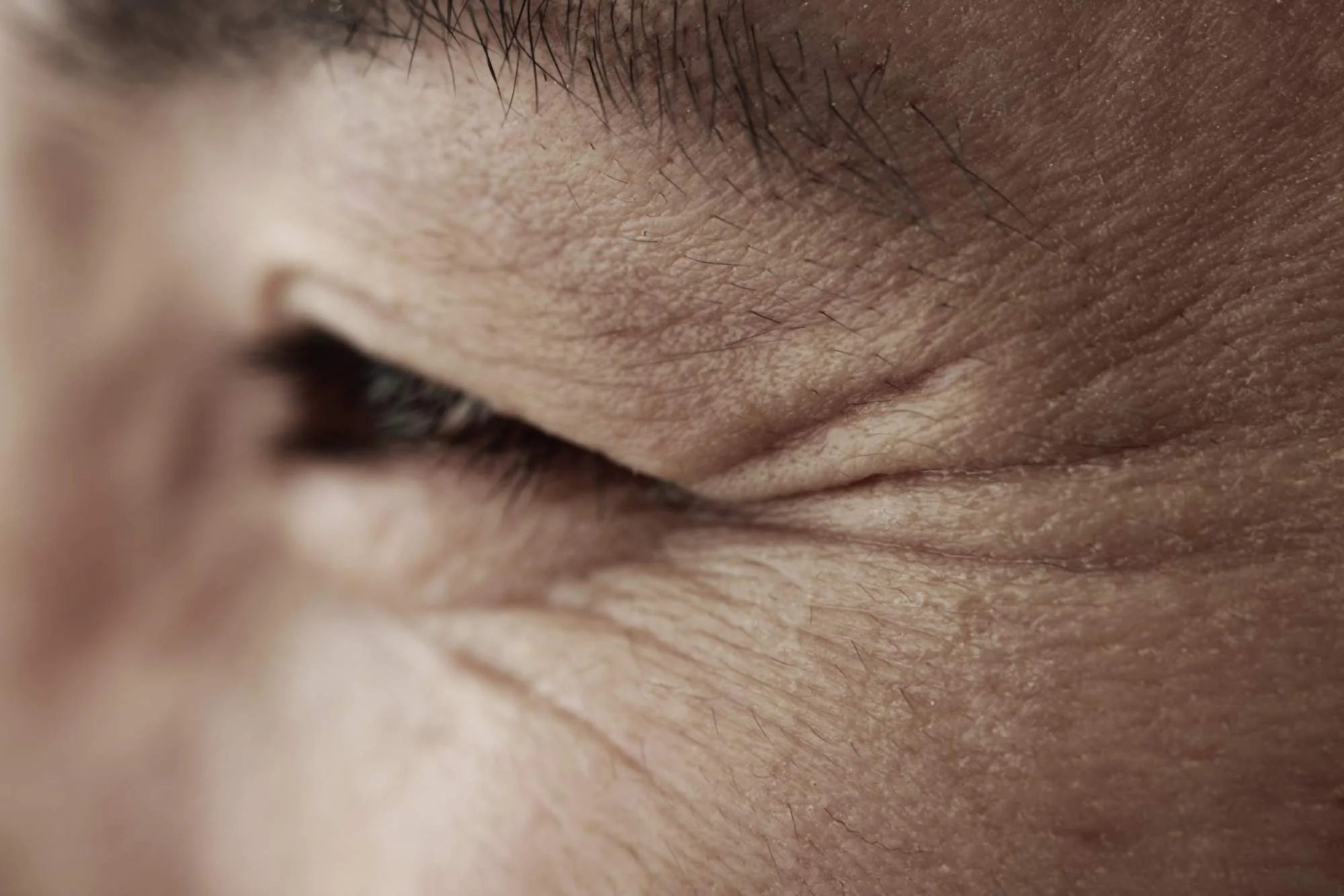 dry skin.jpg
