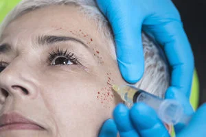 prp on patient.jpg