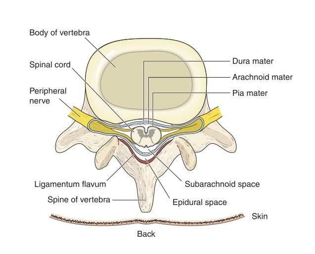 Epidural Steroid Injection